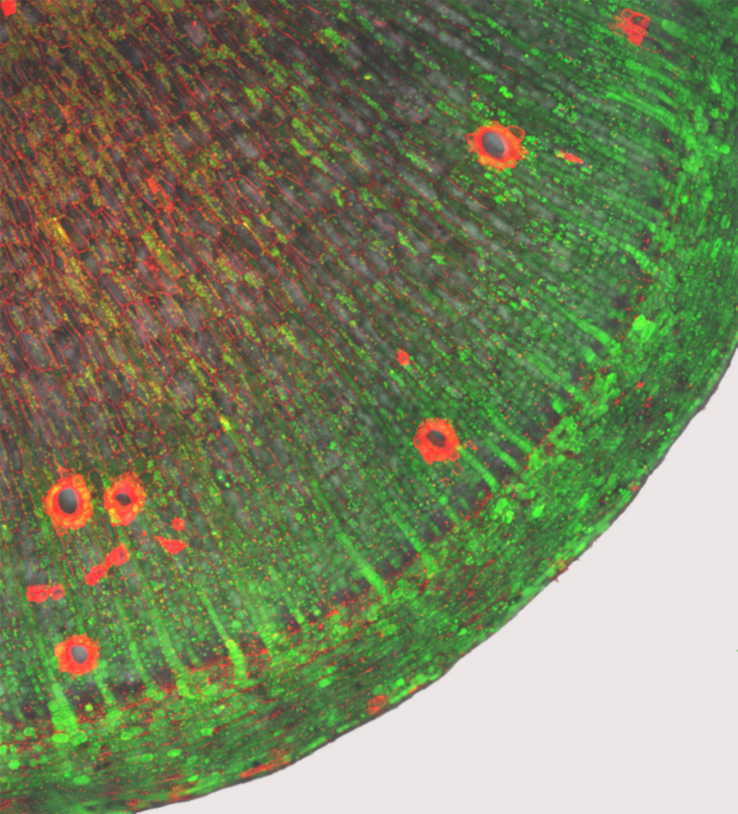 Symplasmic phloem unloading